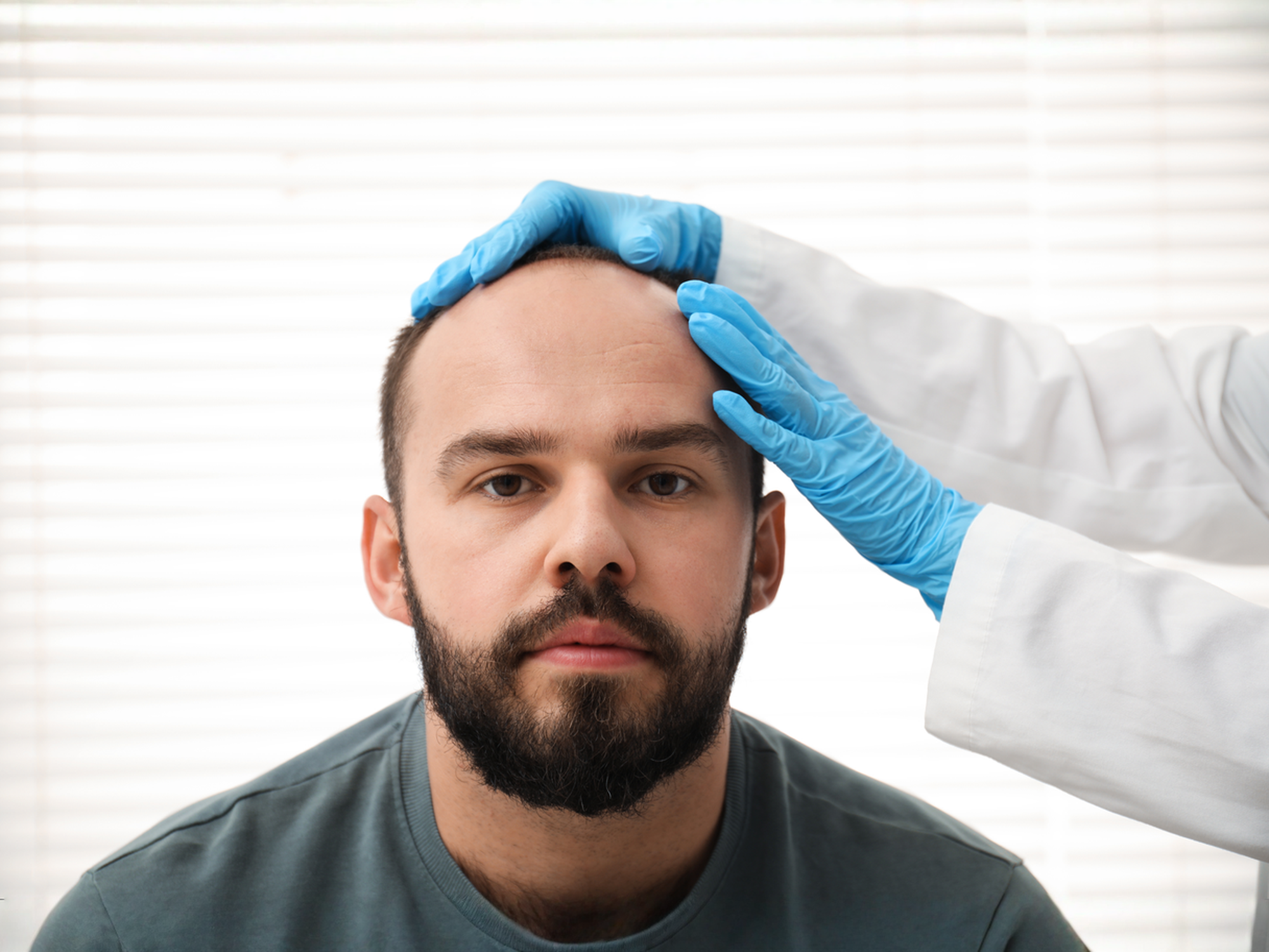 Complete Guide to Hair Transplant in Turkey: What You Need to Know